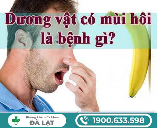 Hình ảnh minh họa